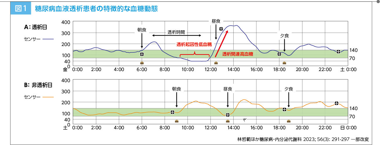 図1:糖尿病血液透析患者の特徴的な血糖動態
