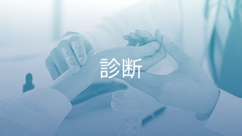 ANCA関連血管炎の治療指針 ～診断～