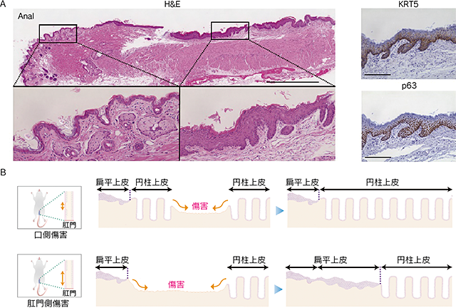 マウスにおける直腸扁平上皮化に関する画像