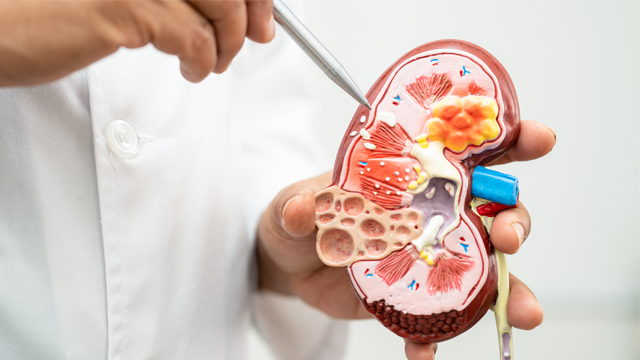 透析患者さんの合併症 慢性腎臓病に伴う骨・ミネラル代謝異常（CKD-MBD）